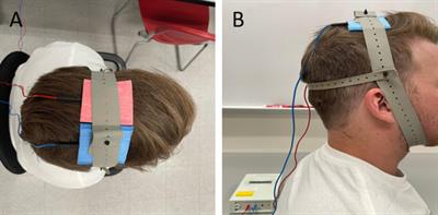 Exploring the use of bimodal transcranial direct current stimulation to enhance movement in individuals with patellofemoral pain—A sham-controlled double blinded pilot study